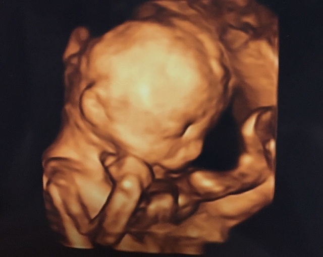 エコー写真 21週5日 21w5d 男の子,妊娠21週,エコー,