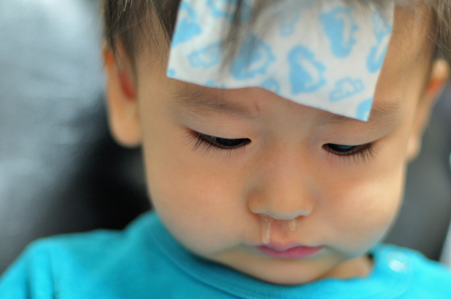 鼻風邪の子ども,滲出性中耳炎,赤ちゃん,