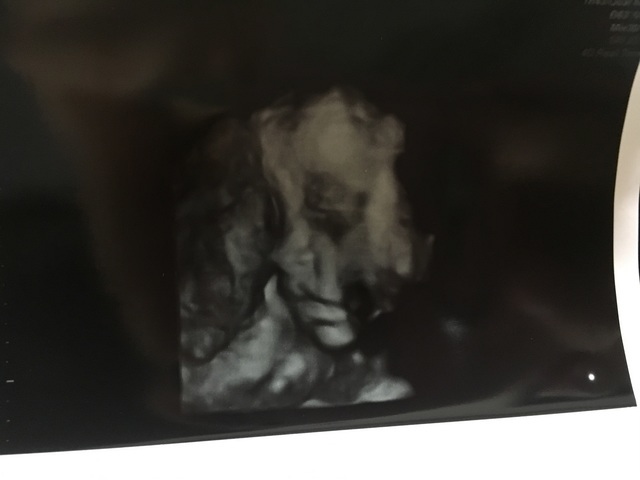 エコー写真 22週2日 22w2d 女の子,妊娠22週,エコー,