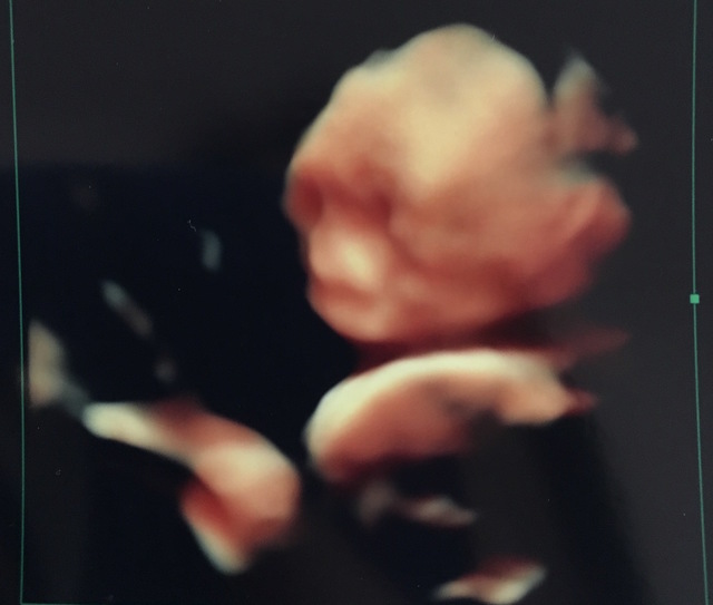 エコー写真 22週3日 22w3d 男の子,妊娠22週,エコー,