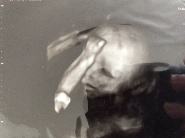 エコー写真 21週5日 21w5d 男の子,妊娠21週,エコー,