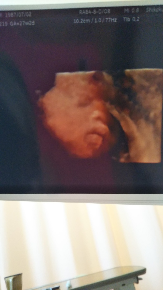 エコー写真 27週2日 27w2d 男の子,妊娠,27週,エコー写真