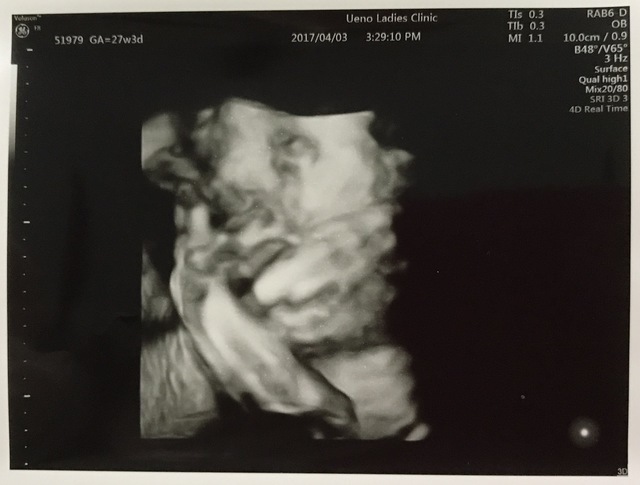 エコー写真 27週3日 27w3d 女の子,妊娠,27週,エコー写真