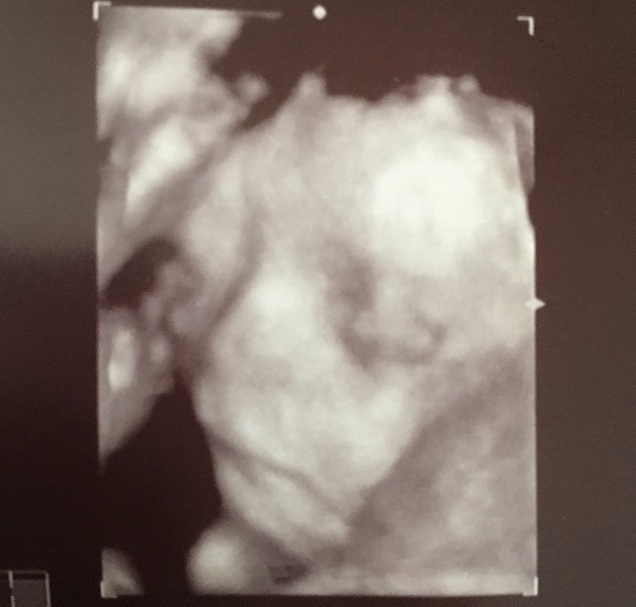 エコー写真 28週0日 28w0d 女の子,妊娠28週,エコー,