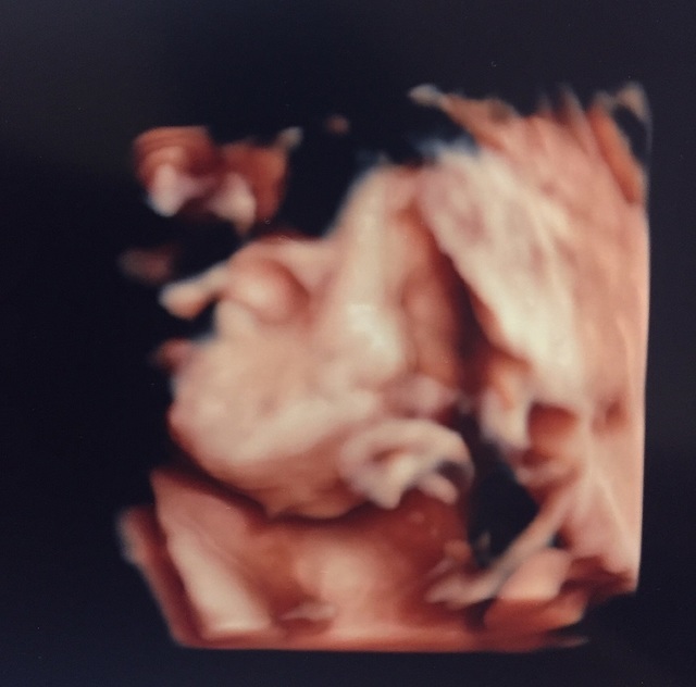 エコー写真 28週3日 28w3d 男の子,妊娠28週,エコー,