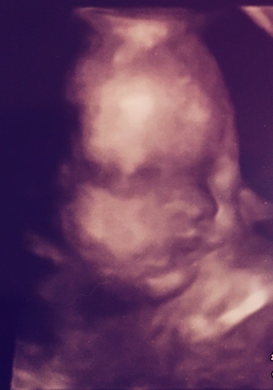 エコー写真 29週0日 29w0d 女の子,妊娠29週,エコー,