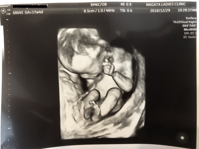 エコー写真 17週4日 17w4d 男の子,妊娠17週,エコー,