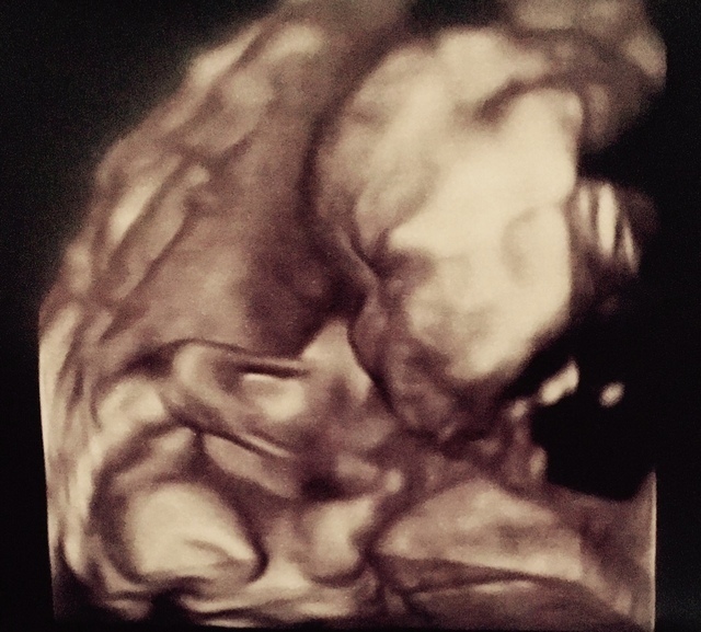 エコー写真 26週2日 26w2d 女の子,妊娠26週,エコー,