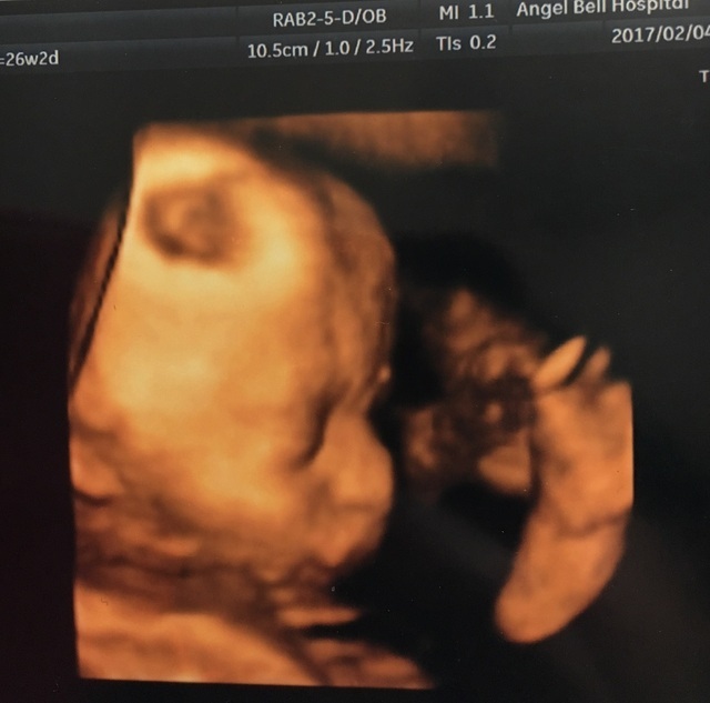 エコー写真 26週2日 26w2d 女の子,妊娠26週,エコー,