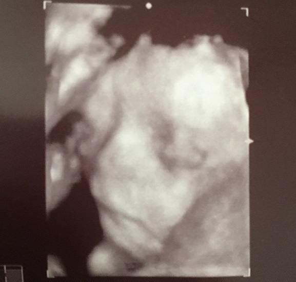 エコー写真 28週0日 28w0d 女の子,妊娠28週,エコー,