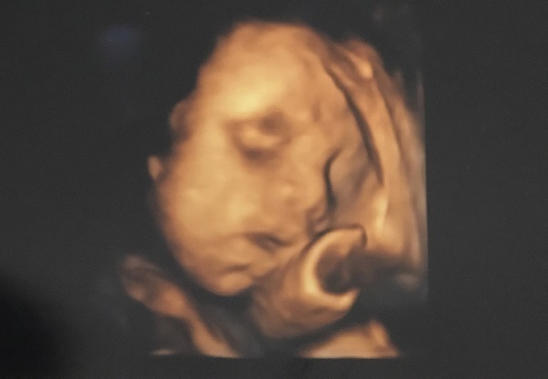 エコー写真 28週0日 28w0d 男の子,妊娠28週,エコー,