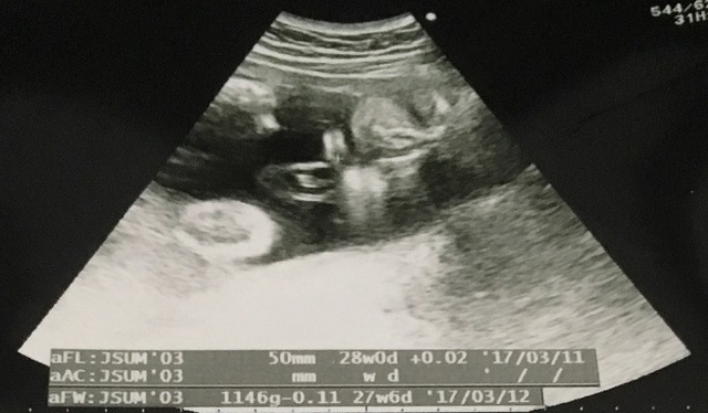 エコー写真 28週0日 28w0d 男の子,妊娠28週,エコー,