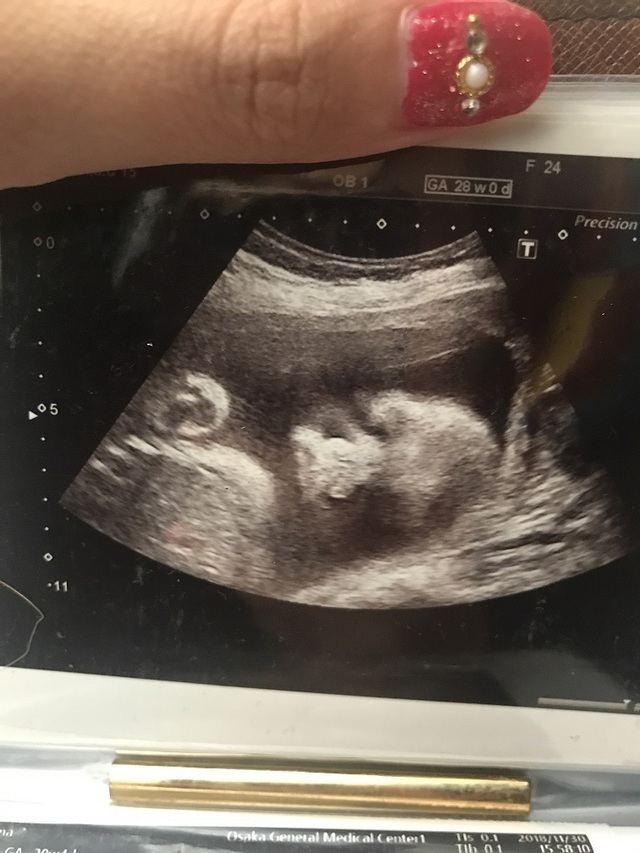 エコー写真 28週1日 28w1d 男の子,妊娠28週,エコー,
