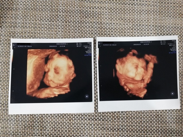 エコー写真 28週2日 28w2d 男の子,妊娠28週,エコー,
