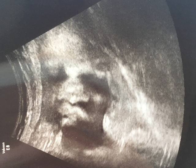 エコー写真 28週3日 28w3d 女の子,妊娠28週,エコー,