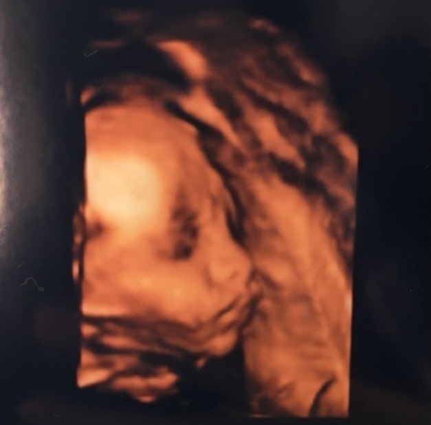 エコー写真 28週3日 28w3d 男の子,妊娠28週,エコー,