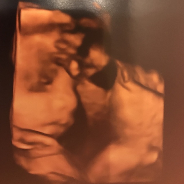 エコー写真 28週6日 28w6d 男の子,妊娠28週,エコー,