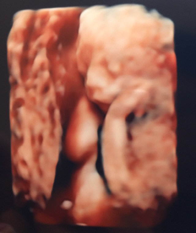 エコー写真 22週0日 22w0d 女の子,妊娠22週,エコー,