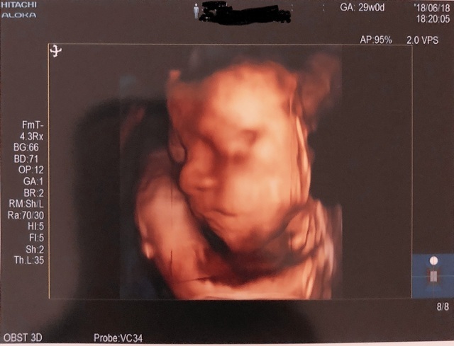 エコー写真 29週0日 29w0d 男の子,妊娠29週,エコー,