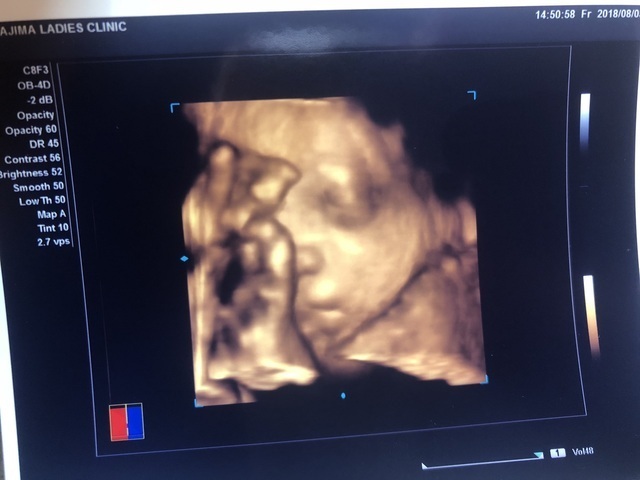 エコー写真 29週1日 29w1d 男の子,妊娠29週,エコー,