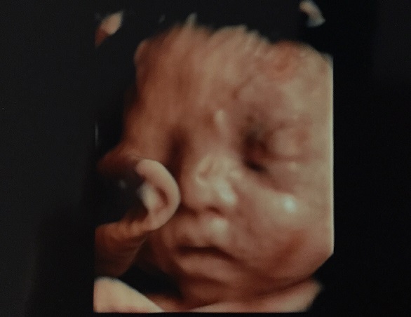 エコー写真 29週3日 29w3d 男の子,妊娠29週,エコー,