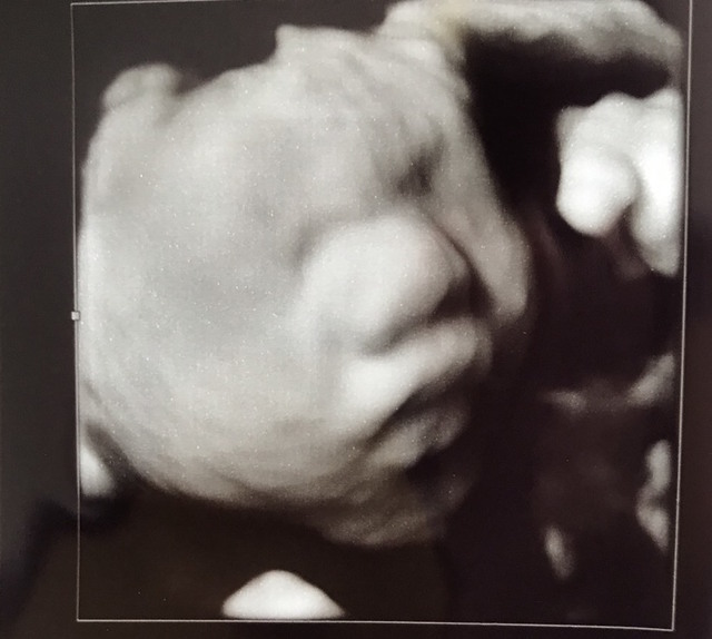 エコー写真 29週4日 29w4d 男の子,妊娠29週,エコー,