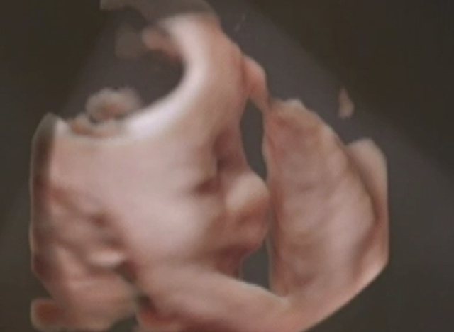 エコー写真 29週6日 29w6d 男の子,妊娠29週,エコー,