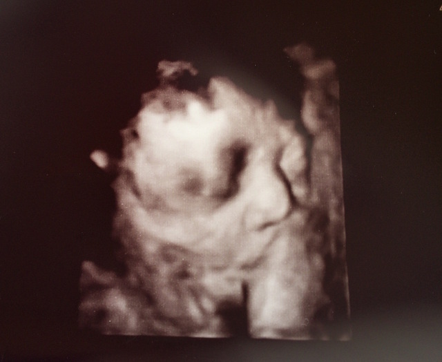 エコー写真 29週4日 29w4d 女の子,妊娠29週,エコー,