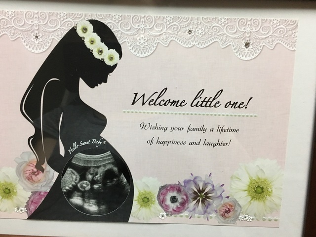 エコー写真 27週1日 27w1d 女の子,妊娠,27週,エコー写真