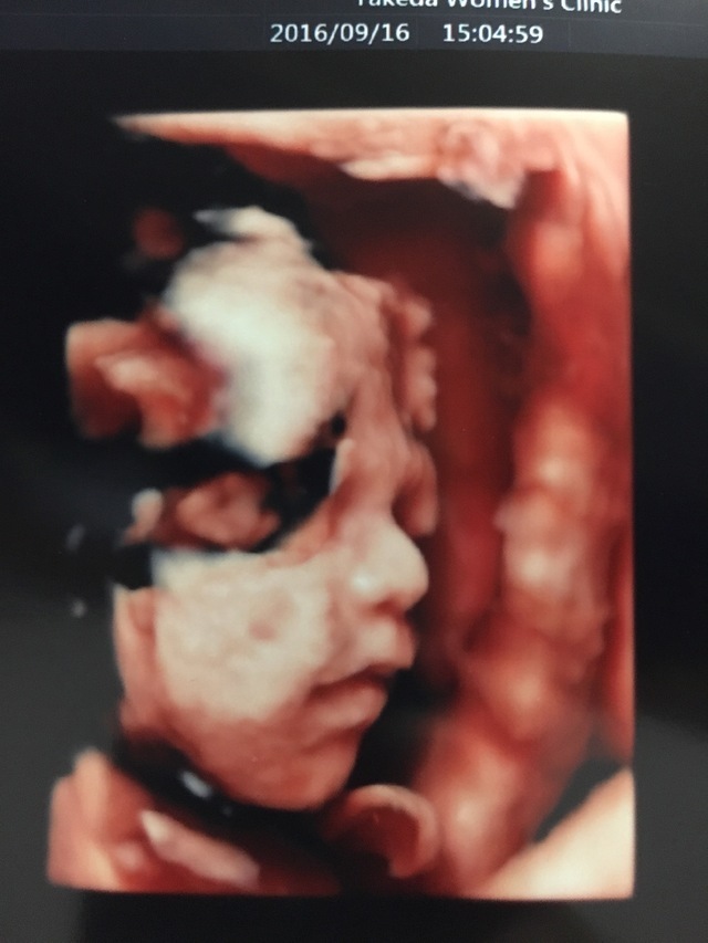 エコー写真 27週2日 27w2d 男の子,妊娠,27週,エコー写真
