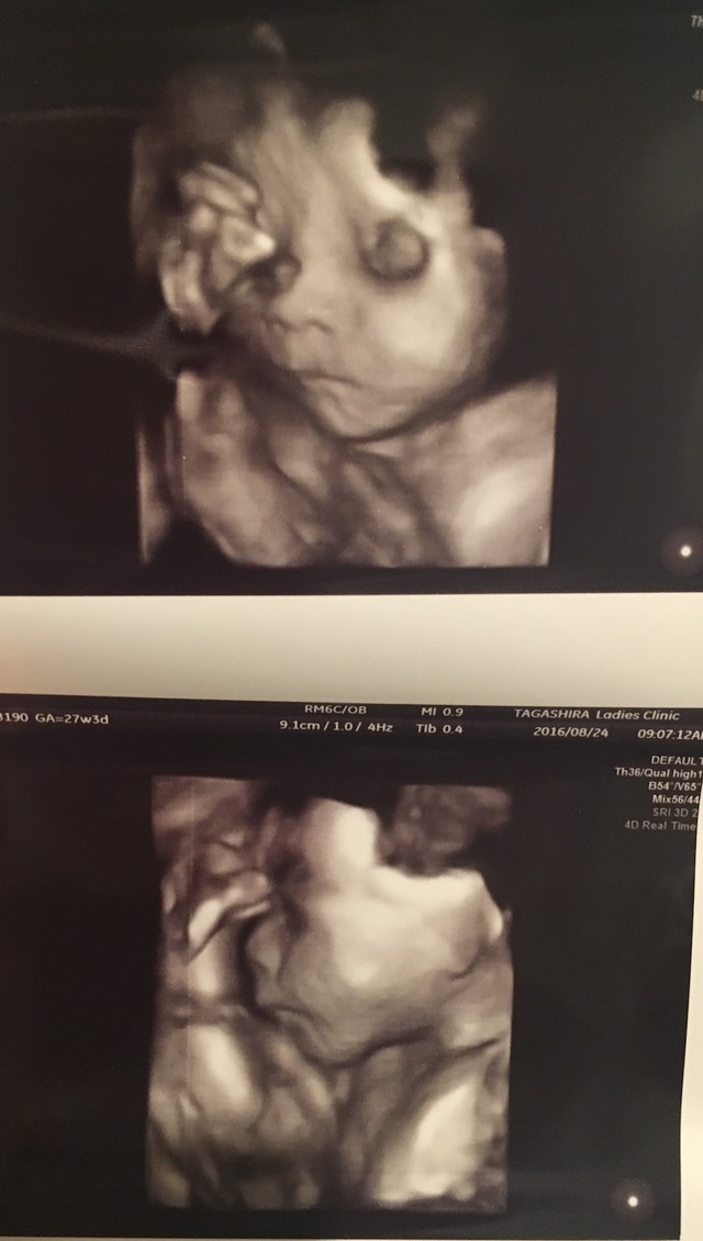エコー写真 27週3日 27w3d 女の子,妊娠,27週,エコー写真