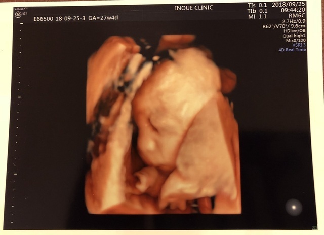 エコー写真 27週4日 27w6d 男の子,妊娠,27週,エコー写真