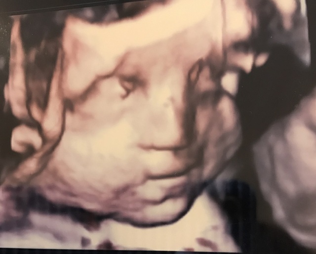 エコー写真 21週0日 21w0d /男の子,妊娠21週,エコー,