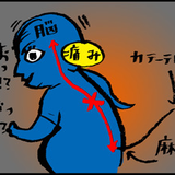 硬膜外麻酔