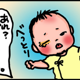 ものもらい