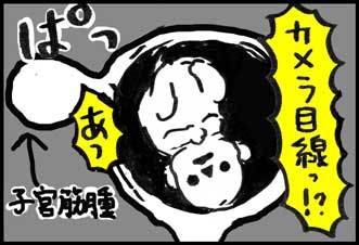 【子育て絵日記4コママンガ】つるちゃんの里帰り|カメラ目線!MRI編