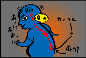 【子育て絵日記4コママンガ】つるちゃんの里帰り|無痛分娩・硬膜外麻酔の効果!編