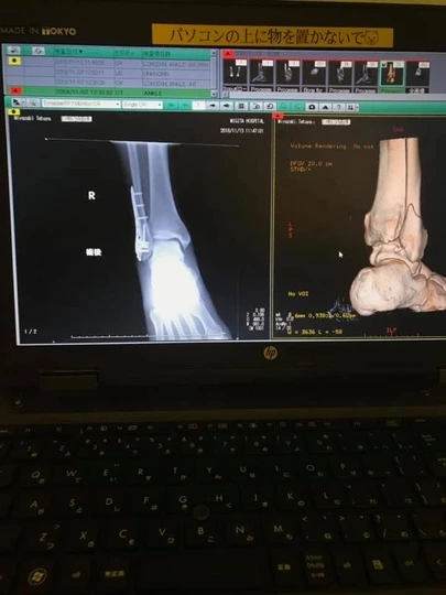 Will Marry(ウィルマリー)「婚活は人生に直結するVol 69「骨折して気付いたこと」」-2