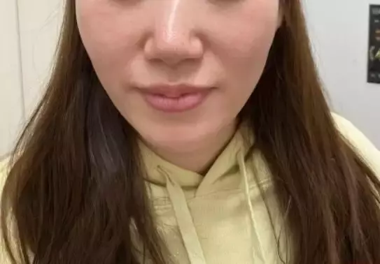 神戸結婚相談所ルートマリッジ「３０代男性におすすめ！monが受けてる美容医療」- 3