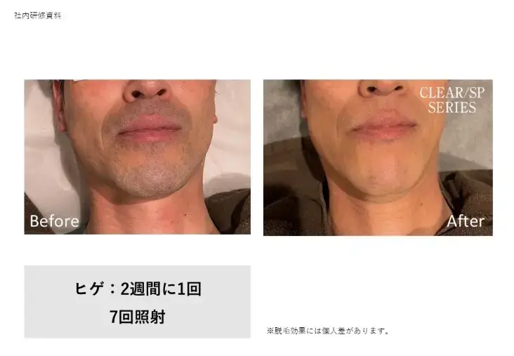 結婚相談所 インシエーメ「とってもお得な男性ご入会特典！」- 3