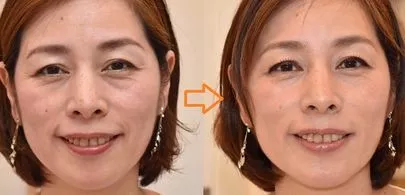 結婚相談室　恵(めぐみ)「婚活メイクレッスンで素敵なご縁を掴みましょう！」-2