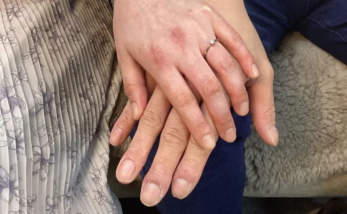 パルティール町田で婚活した20代後半女性の画像3