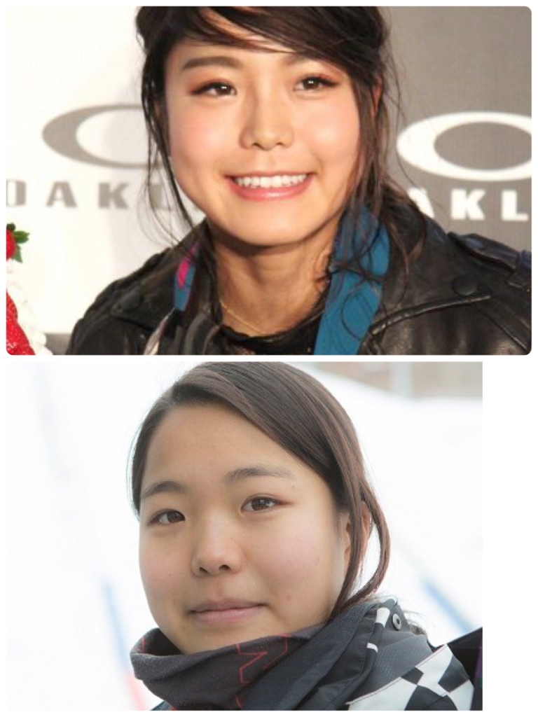 鼻ぺちゃんこ 鼻がぺちゃんこで 悩みです 高くするに 整形しかないですか 意見聞きた