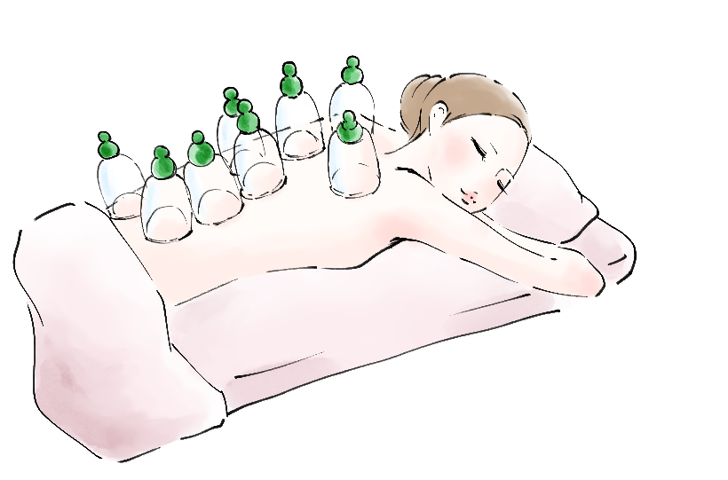 町田・相模大野・古淵、相模原、カッピング療法