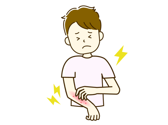 皮膚バリア機能の低下