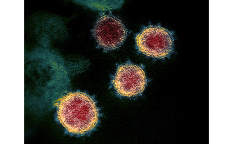 インフォ デミックス と は