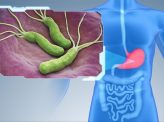 発見から40年！ピロリ菌が今また注目されているワケとは
