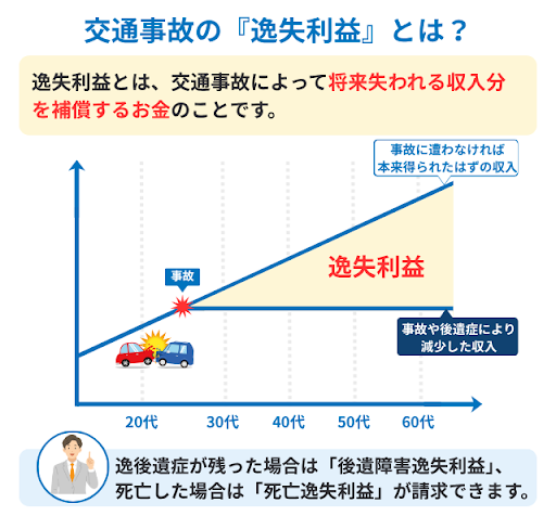 交通事故の「逸失利益」