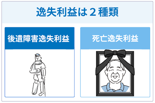 逸失利益の主な種類