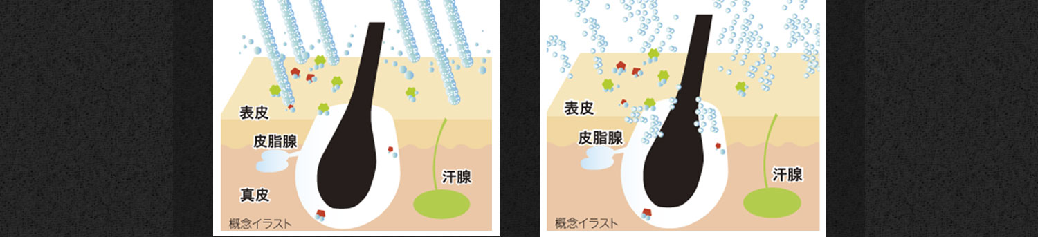 バブルミスト バブルミスト(ミスト水流)は､すぐれた洗浄力を持つウルトラファインバブルをミストで毛穴までしっかり！美肌ケアはもちろん､ヘッドスパや頭皮のクレンジングにも､髪のダメージケアを行う前にもおすすめです｡